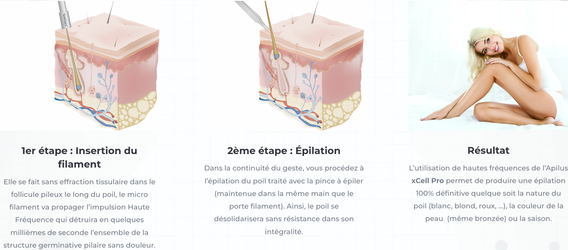 L’épilation électrique devient Réellement définitive Pour toutes les peaux Pour tous les poils Sans risque Sans douleur